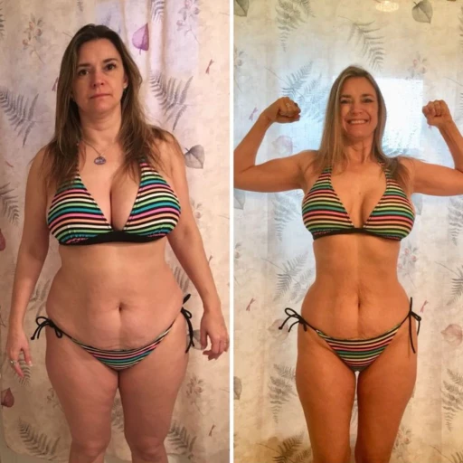 Resultado Elisangela Antes e Depois